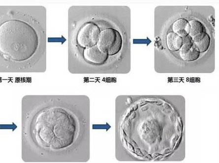 DoitinRussia三代试管婴儿私立机构前三名比较好哪家医院比较好