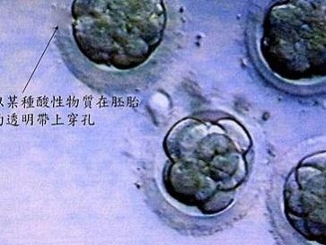 南昌做一次三代试管婴儿费用介绍附三代试管婴儿费用详情介绍